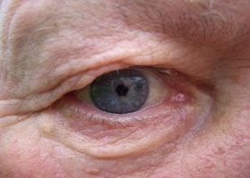 Life Markets and Regulation