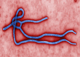 The Economic Impact of Ebola