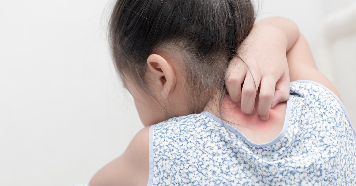 Understanding the burden of adolescent eczema on patients, caregivers